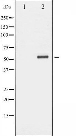 Invitrogen NPY2R Polyclonal Antibody 100 &mu;L; Unconjugated:Antibodies,