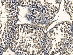 Invitrogen OR10J6P Polyclonal Antibody 100 &mu;L; Unconjugated:Antibodies,
