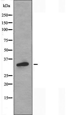 Invitrogen OR2T2/OR2T35 Polyclonal Antibody 100 &mu;L | Buy Online | Invitrogen&trade; | Fisher Scientific