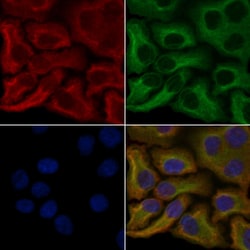 Invitrogen OR6C70 Polyclonal Antibody 100 &mu;L; Unconjugated:Antibodies,