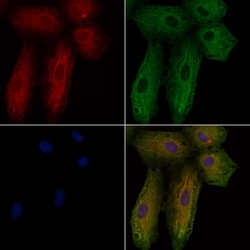 Invitrogen Rhodopsin Polyclonal Antibody 100 &mu;L; Unconjugated:Antibodies,