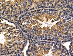 Invitrogen Rhodopsin Polyclonal Antibody 100 &mu;L; Unconjugated:Antibodies,