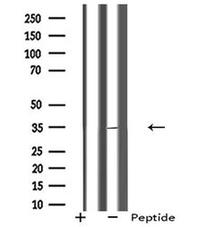 Invitrogen Rhodopsin Polyclonal Antibody 100 &mu;L; Unconjugated:Antibodies,