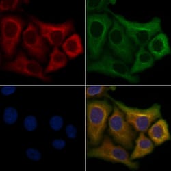 Invitrogen OR2Y1 Polyclonal Antibody 100 &mu;L; Unconjugated:Antibodies,