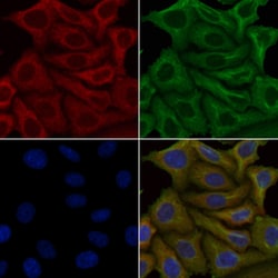 Invitrogen OR4A15 Polyclonal Antibody 100 &mu;L | Buy Online | Invitrogen&trade; | Fisher Scientific