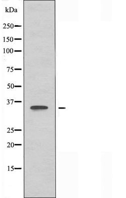 Invitrogen OR4C16 Polyclonal Antibody 100 &mu;L | Buy Online | Invitrogen&trade; | Fisher Scientific