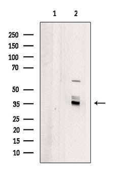 Invitrogen OR4X1 Polyclonal Antibody 100 &mu;L; Unconjugated:Antibodies,