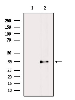 Invitrogen OR5M11 Polyclonal Antibody 100 &mu;L; Unconjugated:Antibodies,