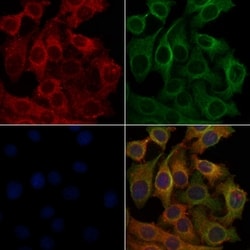 Invitrogen OR6K2 Polyclonal Antibody 100 &mu;L; Unconjugated:Antibodies,