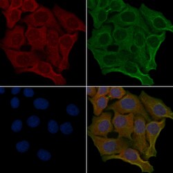 OR6S1 Polyclonal Antibody 100 &mu;L | Buy Online | Invitrogen | Fisher Scientific