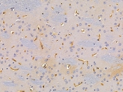OR6S1 Polyclonal Antibody 100 &mu;L | Buy Online | Invitrogen | Fisher Scientific