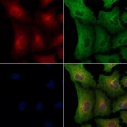 Invitrogen OR8G5 Polyclonal Antibody 100 &mu;L | Buy Online | Invitrogen&trade; | Fisher Scientific