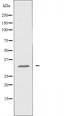 Invitrogen OR8G5 Polyclonal Antibody 100 &mu;L | Buy Online | Invitrogen&trade; | Fisher Scientific