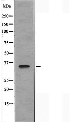 Invitrogen TAS2R13 Polyclonal Antibody 100 &mu;L; Unconjugated:Antibodies,