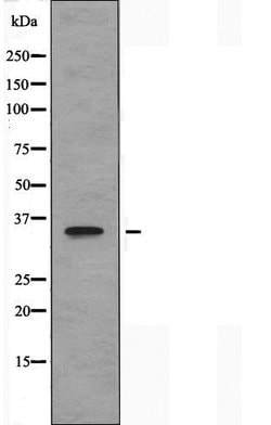 Invitrogen TAS2R5 Polyclonal Antibody 100 &mu;L | Buy Online | Invitrogen&trade; | Fisher Scientific