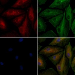 TAS2R8 Polyclonal Antibody, Invitrogen 100 &mu;L; Unconjugated:Antibodies,