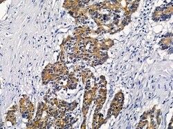 Invitrogen VN1R2 Polyclonal Antibody 100 &mu;L; Unconjugated:Antibodies,