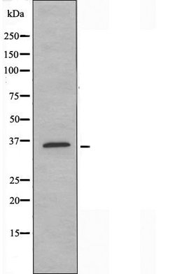 Invitrogen OR52E5 Polyclonal Antibody 100 &mu;L | Buy Online | Invitrogen&trade; | Fisher Scientific