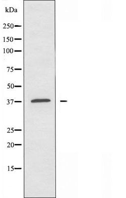 Invitrogen OR10H3/OR10H4 Polyclonal Antibody 100 &mu;L; Unconjugated:Antibodies,