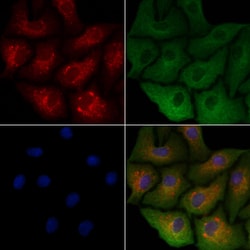 Invitrogen OR5M1/OR5M10 Polyclonal Antibody 100 &mu;L; Unconjugated:Antibodies,