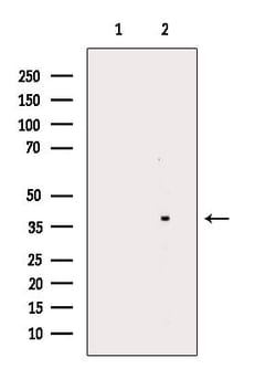 Invitrogen OR5M1/OR5M10 Polyclonal Antibody 100 &mu;L; Unconjugated:Antibodies,