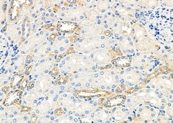 Invitrogen Perforin Polyclonal Antibody 100 &mu;L; Unconjugated:Antibodies,