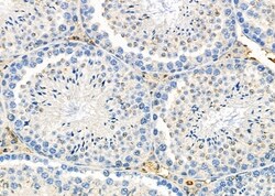 Invitrogen Perforin Polyclonal Antibody 100 &mu;L; Unconjugated:Antibodies,