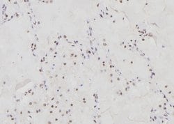 CHOP Polyclonal Antibody, Invitrogen 100 &mu;L; Unconjugated:Antibodies,