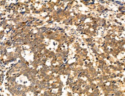 CHOP Polyclonal Antibody, Invitrogen 100 &mu;L; Unconjugated:Antibodies,