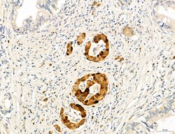 CHOP Polyclonal Antibody, Invitrogen 100 &mu;L; Unconjugated:Antibodies,