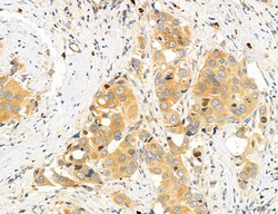 CHOP Polyclonal Antibody, Invitrogen 100 &mu;L; Unconjugated:Antibodies,