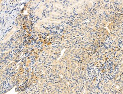 CHOP Polyclonal Antibody, Invitrogen 100 &mu;L; Unconjugated:Antibodies,