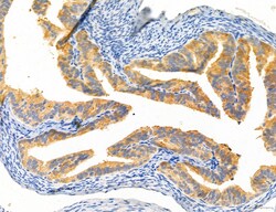CHOP Polyclonal Antibody, Invitrogen 100 &mu;L; Unconjugated:Antibodies,