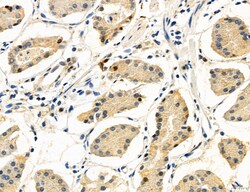 CHOP Polyclonal Antibody, Invitrogen 100 &mu;L; Unconjugated:Antibodies,