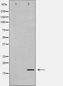 Invitrogen TGF alpha Polyclonal Antibody 100 &mu;L; Unconjugated:Antibodies,