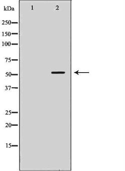 STEAP3 Polyclonal Antibody, Invitrogen 100 &mu;L; Unconjugated:Antibodies,