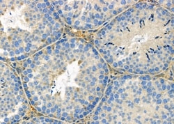 Invitrogen ATG13 Polyclonal Antibody 100 &mu;L; Unconjugated:Antibodies,
