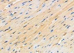 Invitrogen SNX9 Polyclonal Antibody 100 &mu;L; Unconjugated:Antibodies,