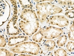 Invitrogen cIAP1 Polyclonal Antibody 100 &mu;L; Unconjugated:Antibodies,