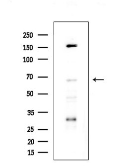 Invitrogen cIAP1 Polyclonal Antibody 100 &mu;L; Unconjugated:Antibodies,