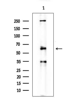 Invitrogen cIAP1 Polyclonal Antibody 100 &mu;L; Unconjugated:Antibodies,