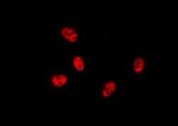 Invitrogen cIAP1 Polyclonal Antibody 100 &mu;L; Unconjugated:Antibodies,
