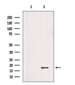 Invitrogen ID2 Polyclonal Antibody 100 &mu;L | Buy Online | Invitrogen&trade; | Fisher Scientific