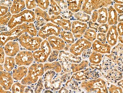 Invitrogen NCK1 Polyclonal Antibody 100 &mu;L; Unconjugated:Antibodies,