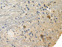 Invitrogen NCK1 Polyclonal Antibody 100 &mu;L; Unconjugated:Antibodies,