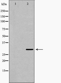 Invitrogen™ Carbonic Anhydrase I Polyclonal Antibody