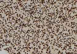 Invitrogen ENO1 Polyclonal Antibody 100 &mu;L | Buy Online | Invitrogen&trade; | Fisher Scientific