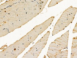 Invitrogen ENO1 Polyclonal Antibody 100 &mu;L | Buy Online | Invitrogen&trade; | Fisher Scientific