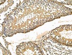 Invitrogen ENO1 Polyclonal Antibody 100 &mu;L | Buy Online | Invitrogen&trade; | Fisher Scientific