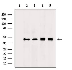 Invitrogen ENO1 Polyclonal Antibody 100 &mu;L | Buy Online | Invitrogen&trade; | Fisher Scientific